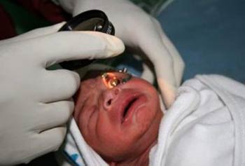 ضرورت معاینه چشم نوزادان نارس